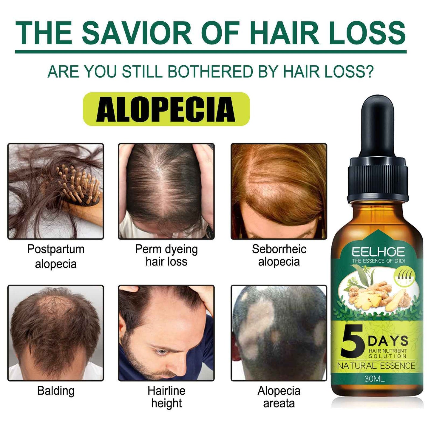 EELHOE Ginger Hair Oil Moisturizing Smooth Hair Repair Frizzy Damaged Hair Care Essential Oil
